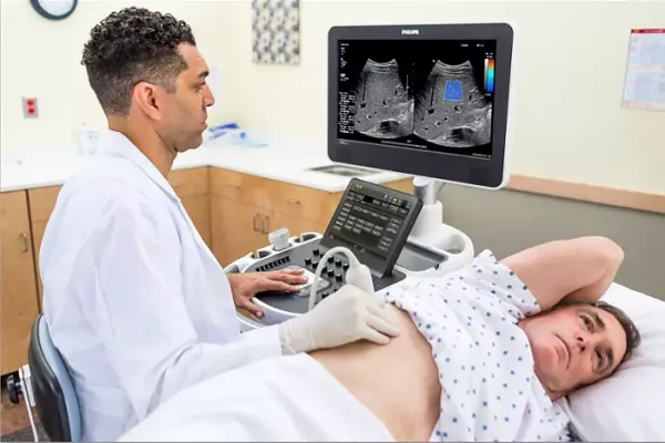 Philips_ElastQ_Imaging_shear_wave_elastography-ALI-global